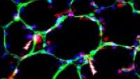 Image of mitochondrial regulation of acute lung injury.